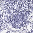 Immunohistochemical staining of human lymph node shows no positivity in germinal center cells as expected.