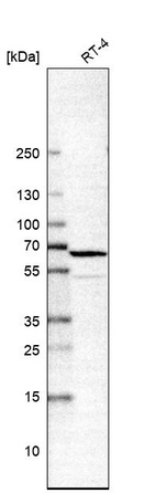 Western blot analysis in human cell line RT-4.