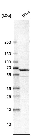 Western blot analysis in human cell line RT-4.