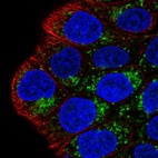 Immunofluorescent staining of human cell line RT4 shows localization to mitochondria.