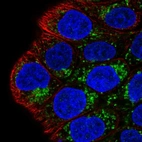 Immunofluorescent staining of human cell line RT4 shows localization to mitochondria.