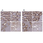 Immunohistochemical staining of human fallopian tube, gastrointestinal, prostate and skeletal muscle using Anti-GSS antibody HPA059315 (A) shows similar protein distribution across tissues to independent antibody HPA054508 (B).
