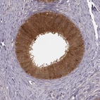 Immunohistochemical staining of human epididymis shows strong cytoplasmic and membranous positivity in glandular cells.