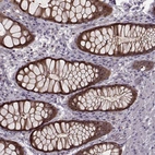 Immunohistochemical staining of human rectum shows strong cytoplasmic and membranous positivity in glandular cells.