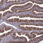 Immunohistochemical staining of human fallopian tube shows strong cytoplasmic and membranous positivity in glandular cells.