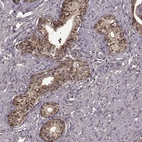Immunohistochemical staining of human prostate shows strong cytoplasmic positivity in glandular cells.