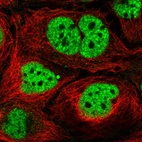 Anti-N4BP2L2 Antibody