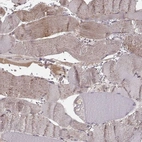 Immunohistochemical staining of human skeletal muscle shows very weak cytoplasmic positivity in myocytes.