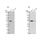 Western blot analysis using Anti-GSS antibody HPA059315 (A) shows similar pattern to independent antibody HPA054508 (B).