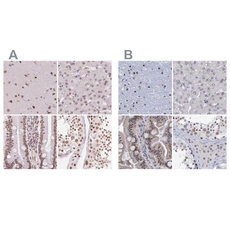Anti-SREK1 Antibody
