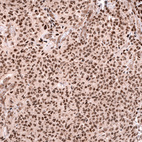 Anti-FOXO3 Antibody