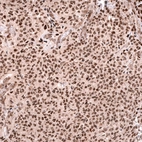Anti-FOXO3 Antibody