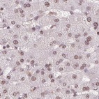Immunohistochemical staining of human liver using Anti-SREK1 antibody HPA059332.
