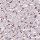 Anti-SREK1 Antibody