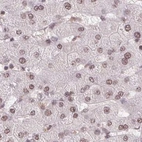 Immunohistochemical staining of human liver using Anti-SREK1 antibody HPA059332.