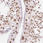 Anti-SREK1 Antibody