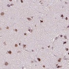 Anti-SREK1 Antibody