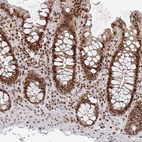 Anti-ZDHHC12 Antibody