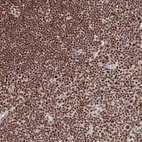 Immunohistochemical staining of human lymph node shows strong nuclear positivity in non-germinal center cells.