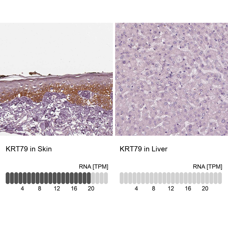 Anti-KRT79 Antibody