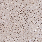 Immunohistochemical staining of human liver shows strong nuclear positivity in hepatocytes.