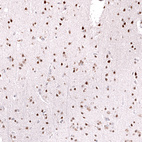 Immunohistochemical staining of human cerebral cortex shows strong nuclear positivity in neurons.