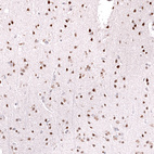 Anti-FOXO3 Antibody