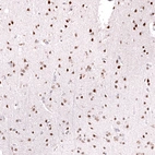 Immunohistochemical staining of human cerebral cortex shows strong nuclear positivity in neurons.