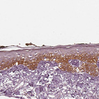 Immunohistochemical staining of human skin shows moderate cytoplasmic positivity in squamous epithelial cells.