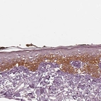 Immunohistochemical staining of human skin shows moderate cytoplasmic positivity in squamous epithelial cells.