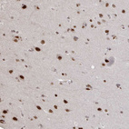 Immunohistochemical staining of human cerebral cortex shows strong nuclear positivity in neurons.