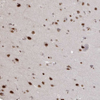 Anti-ZDHHC12 Antibody