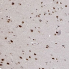 Immunohistochemical staining of human cerebral cortex shows strong nuclear positivity in neurons.