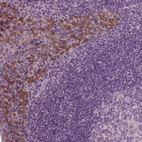 Immunohistochemical staining of human tonsil shows moderate cytoplasmic positivity in squamous epithelial cells.