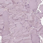 Immunohistochemical staining of human skeletal muscle shows no positivity in myocytes as expected.