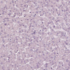 Immunohistochemical staining of human liver shows no positivity in hepatocytes as expected.