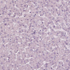 Anti-KRT79 Antibody