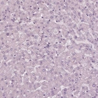 Immunohistochemical staining of human liver shows no positivity in hepatocytes as expected.