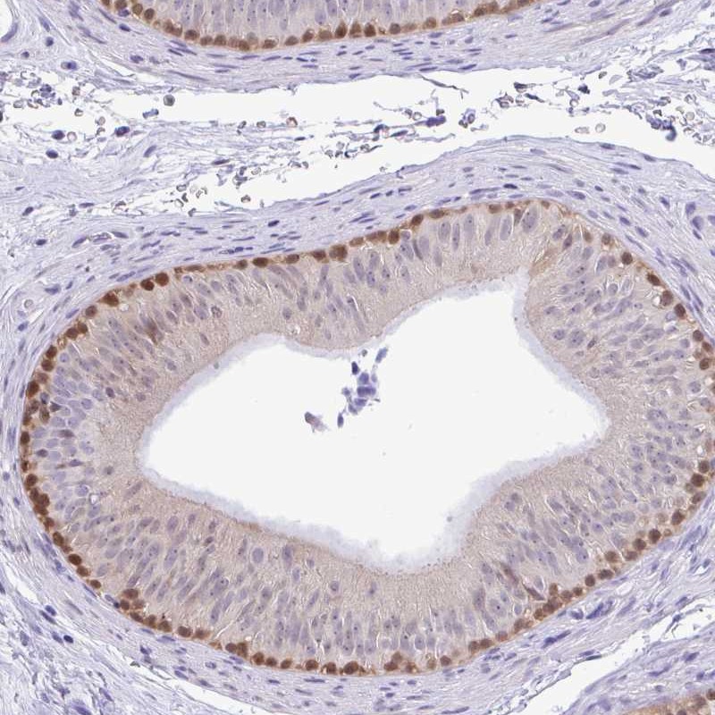 Anti-ZNF485 Antibody