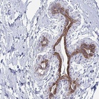 Anti-FAM46D Antibody