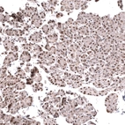 Immunohistochemical staining of human pancreas shows moderate nuclear positivity in exocrine glandular cells.