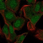 Anti-PRM1 Antibody