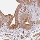 Anti-TMEM222 Antibody