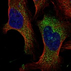 Immunofluorescent staining of human cell line U-2 OS shows localization to cytosol.