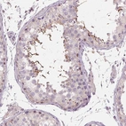 Immunohistochemical staining of human testis shows high expression.