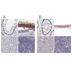 Anti-GRK1 Antibody