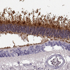 Anti-GRK1 Antibody