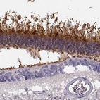 Immunohistochemical staining of human eye, retina using Anti-GRK1 antibody HPA059376.