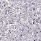 Anti-GRK1 Antibody