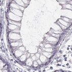 Anti-GRK1 Antibody